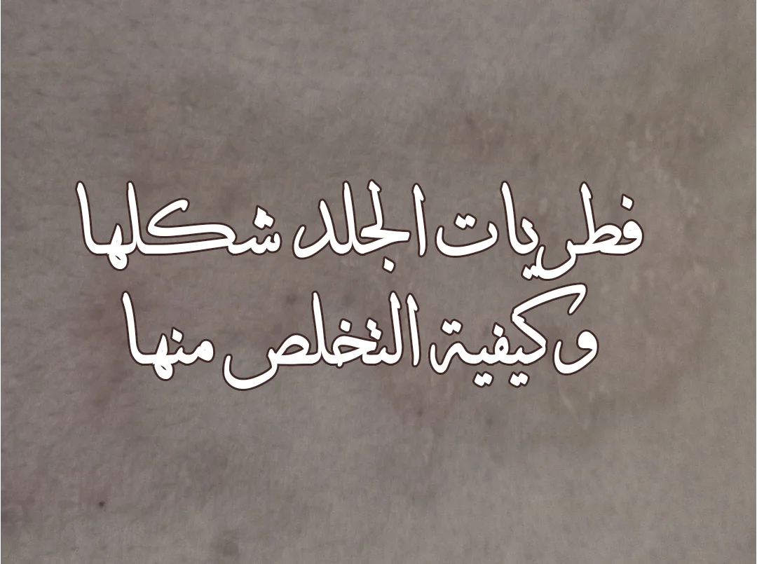فطريات الجلد